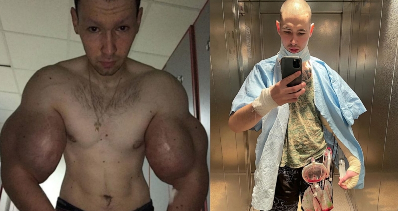 Декстер Джексон синтол
